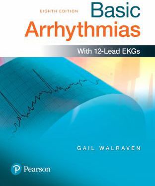 Basic Arrhythmias