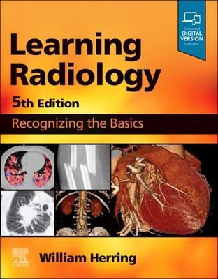 Learning Radiology E-Book : Learning Radiology E-Book